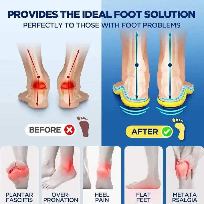 Ergonomic Magnetic Comfort Insoles, Trim-To-Fit Cushioned Arch Support Shoe Inserts for Men Women Daily Walking